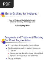 Bone Grafting For Implants