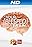 Your Bleeped Up Brain