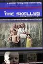 The Skellys (2011)