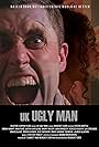 UK Ugly Man