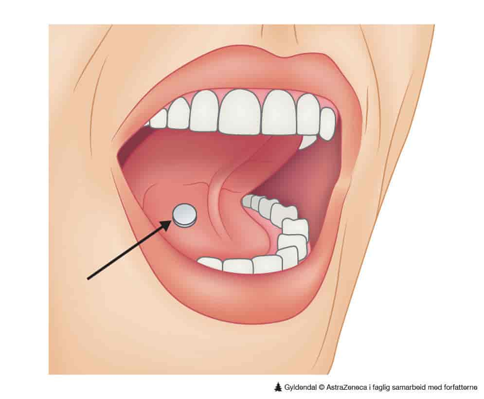 Resoribletter