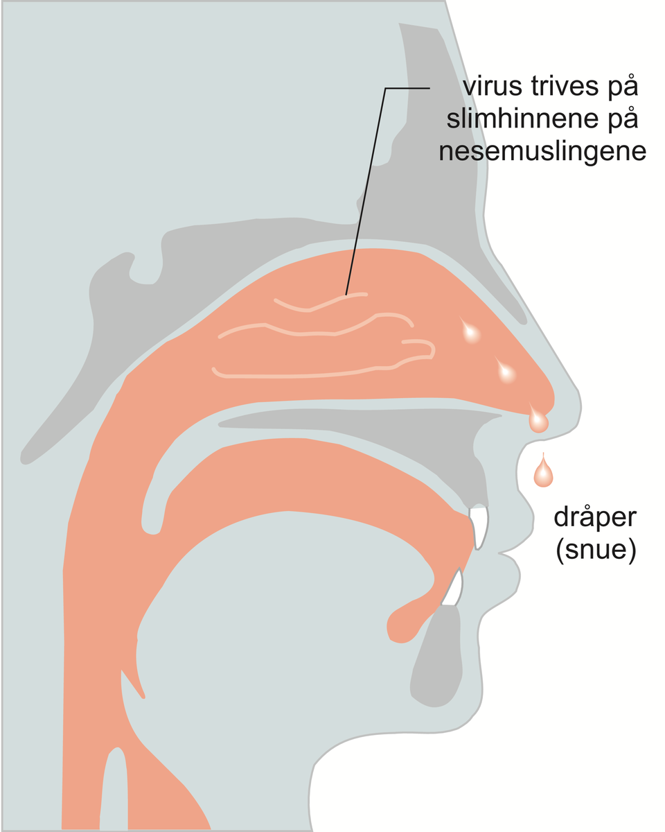 Forkjølelse.