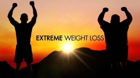 Extreme Weight Loss