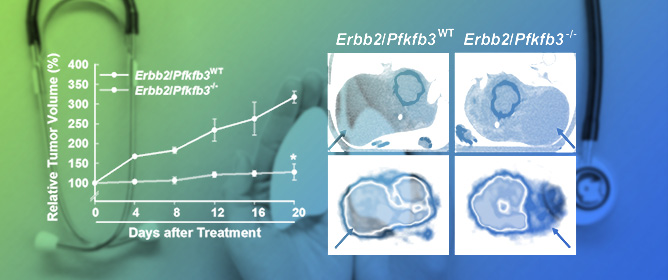 Genomic Deletion of PFKFB3 Decreases In Vivo Tumorigenesis