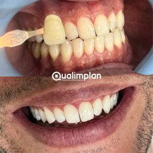 Qualimplan_Foto-21