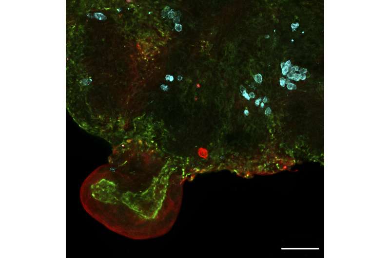 Scientists have used cells from fluid drawn during pregnancy to grow mini lungs and other organs