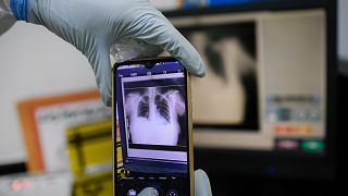 Um profissional de saúde tira uma fotografia das radiografias de tórax de um paciente num hospital na Venezuela em março de 2021.