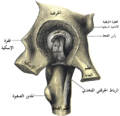 Left hip-joint, opened by removing the floor of the acetabulum from within the pelvis.