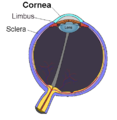 Ο κερατοειδής χιτώνας (cornea).