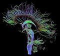 Diffusion MRI (nom)