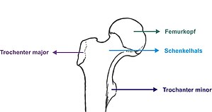 Schenkelhals und Femurkopf