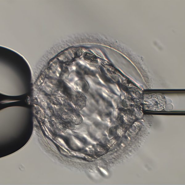 Gentesting av befruktede egg (PGT/PGD)