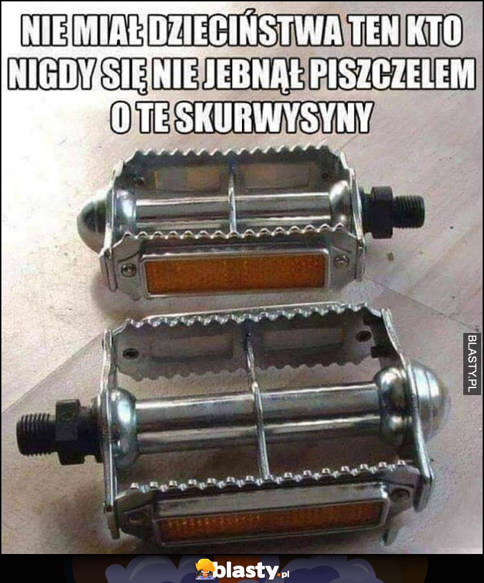Nie miał dzieciństwa ten kto nigdy nie jebnął się piszczelem o te skurczybyki pedały rowerowe Nie miał dzieciństwa ten kto nigdy nie jebnął się piszczelem o te skurczybyki pedały rowerowe