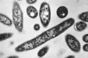 Legionnaires_Explainer_9185_ FILE – This 1978 electron microscope image made available by the Centers for Disease Control and Prevention shows Legionella pneumophila bacteria which are responsible for causing the pneumonic disease Legionnaires’ disease. (Francis Chandler/CDC via AP, File)
