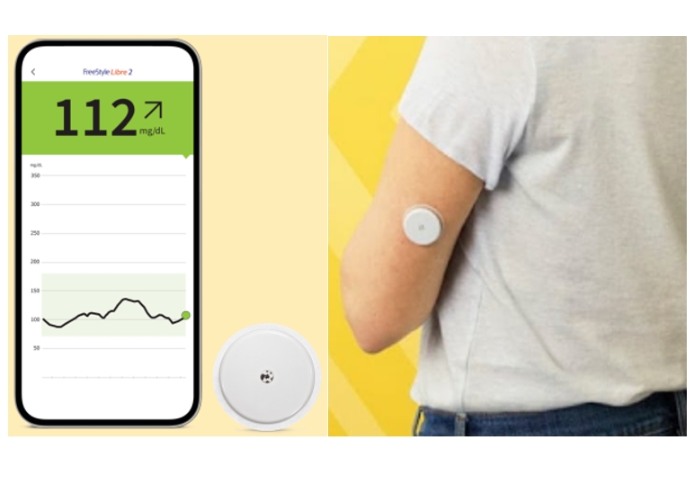 全天監控血糖波動，糖尿病管理更輕鬆！ 血糖管理新利器：連續血糖監測儀 (Continuous Glucose Monitoring, CGM)
